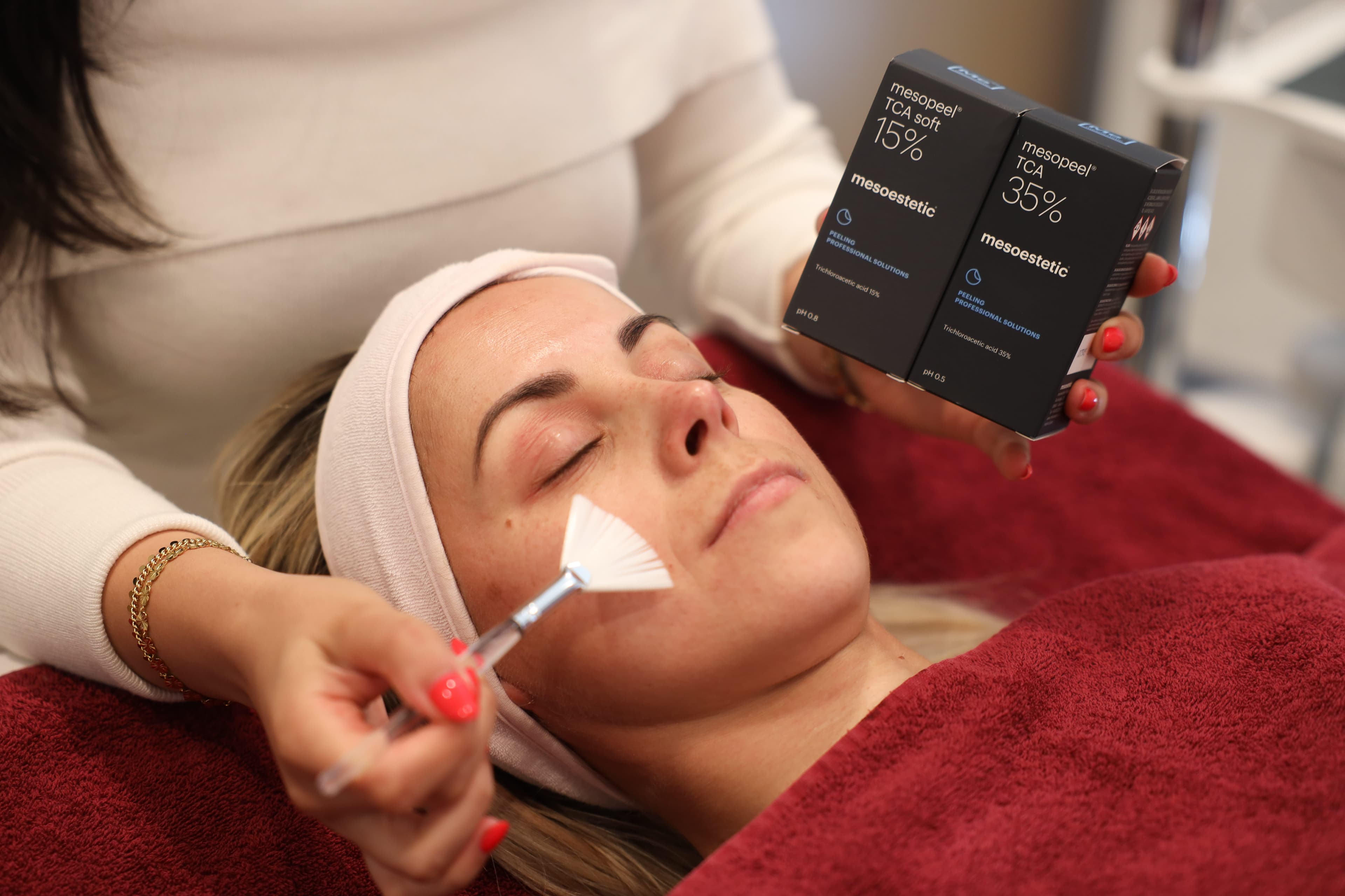 TCA Peel + Dermapen 4